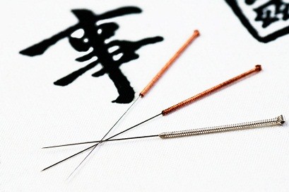 Acupuncture therapy Galway
